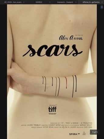 Scars