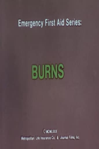 Emergency First Aid Series: Burns